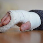 Hilfe durch optimale Handrehabilitation