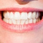 Angstfrei zu gesunden Zähnen und einem strahlenden Lächeln