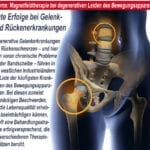 Magnetfeldtherapie bei Gelenk-und Rückenerkrankungen