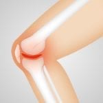 Positive Ergebnisse bei Arthrose und Arthritis mit der Magnetfeldtherapie