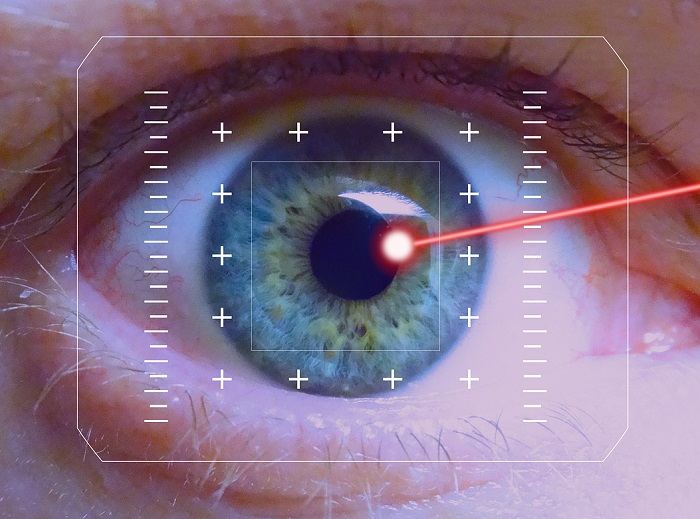 In wenigen Minuten kann durch die Augen-Laserbehandlung eine wesentliche Verbesserung der Sehkraft erreicht werden Auge bei einer Laseroperation