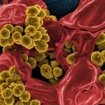 Phagentherapie – Hilfe bei Antibiotika resistenten MRSA Krankenhauskeimen