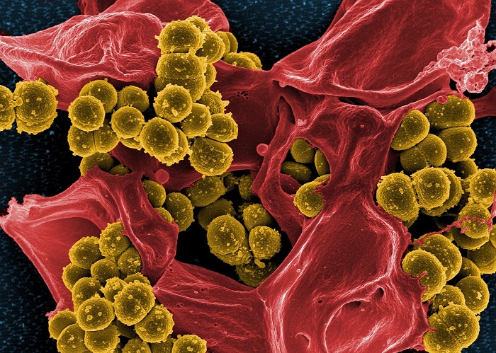 Bakterien im Elekronenmikroskop