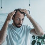 PRP Behandlung gegen Haarausfall