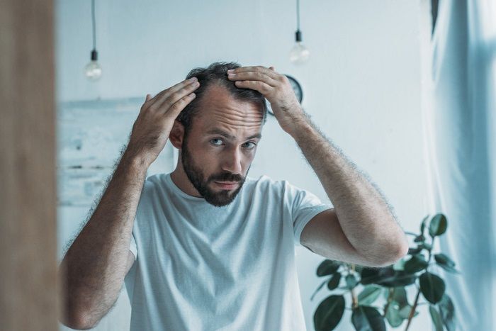 Viele Menschen leiden unter Haarausfall. Eine vielversprechende Methode diesen zu stoppen ist die PRP Behandlung Mann schaut sich im Spiegel seinen Haaransatz an