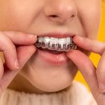 5 Tipps gegen Zahnfehlstellungen – und ihre Ursachen