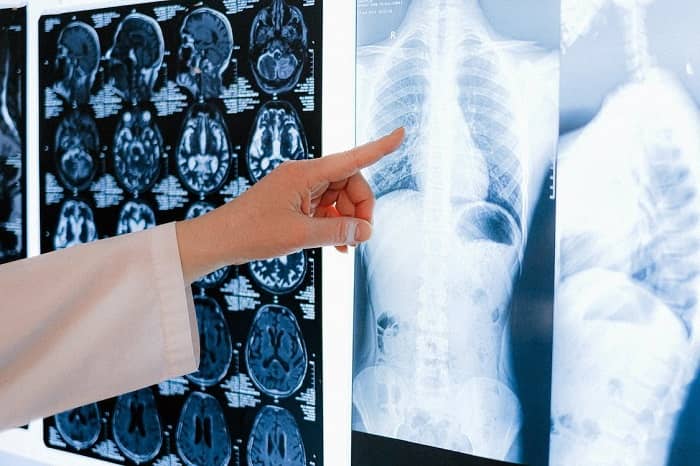 Eine Ärztin zeigt auf einen Bildschirm, wo eine Röntgenaufnahme hängt