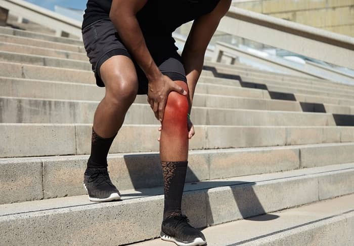 Ein Mann steht mit kurzer Hose auf einer Treppe und hält sich sein gerötetes Knie